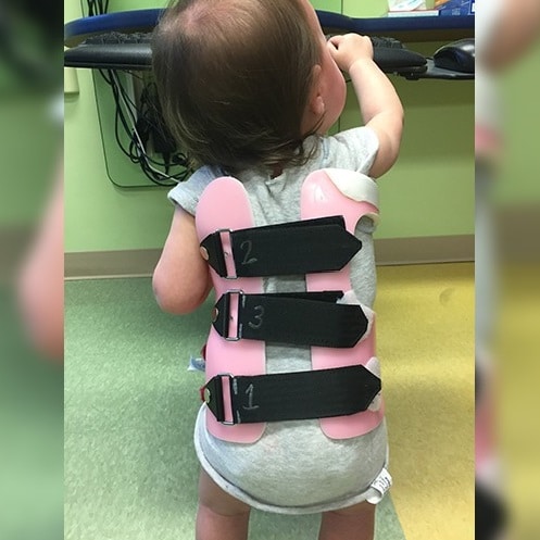 Introduction to the Boston Brace Baby Orthosis